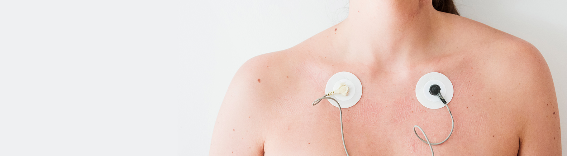 Electrocardiograma (ECG)