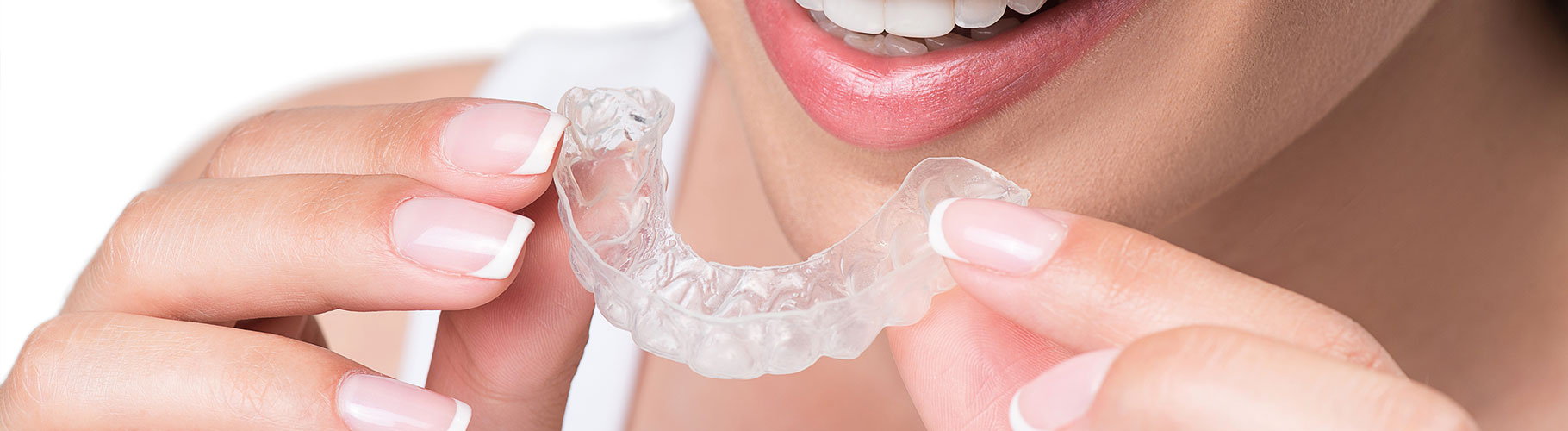 Ortodontia/Aparelho Fixo